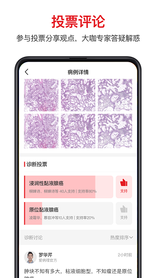 爱病理截图3